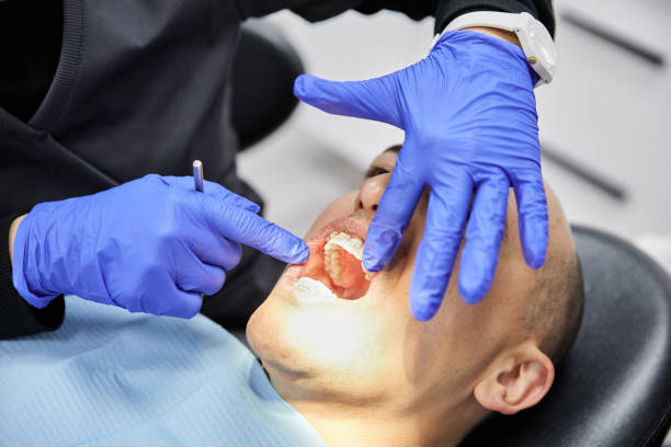 Best Emergency Gum Treatment in Jourdanton, TX